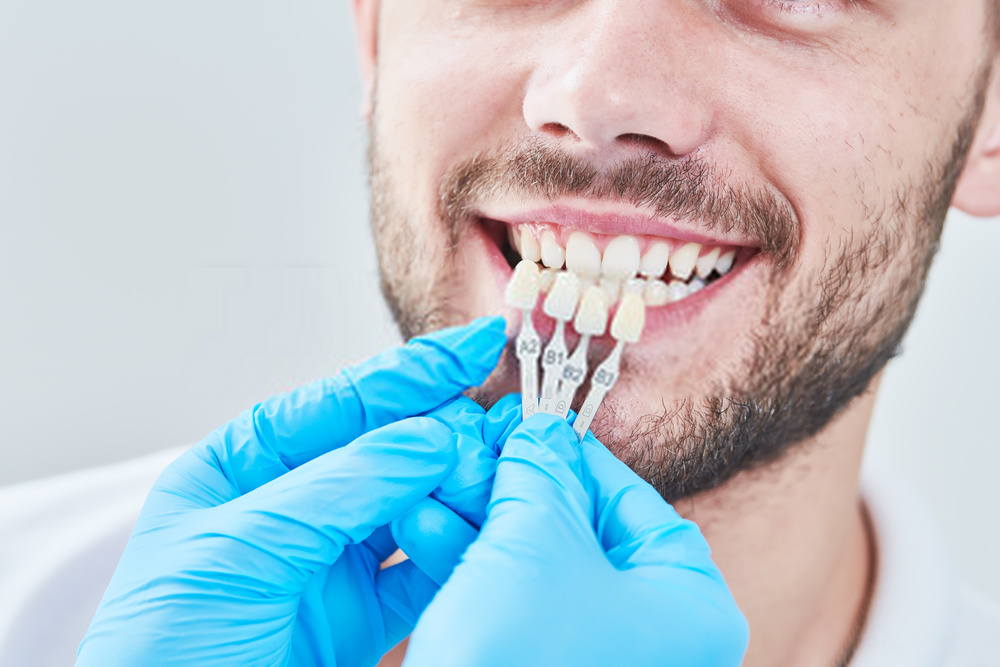 Implante Dentário Gratuito: Como e onde encontrar - MaisOdonto