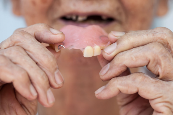 Ponte Dentária Móvel O Que é Como Funciona E Cuidados Maisodonto 9715