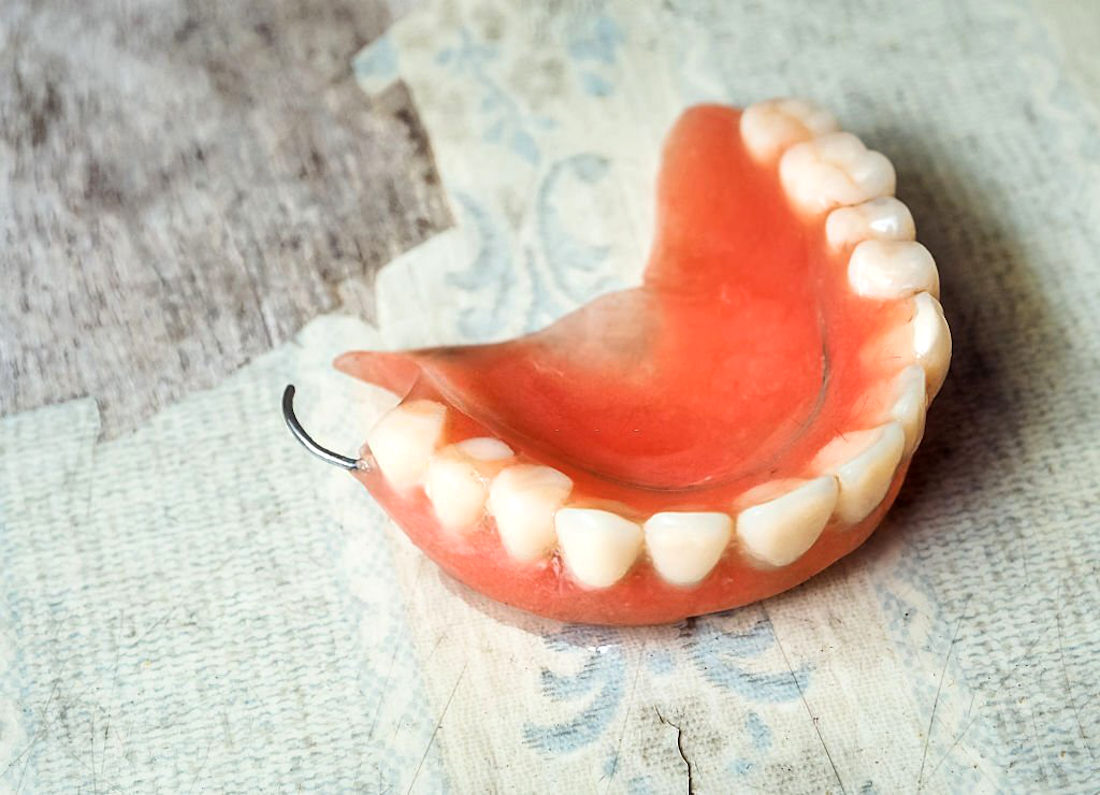 Tipos de prótese dentária dentaduras
