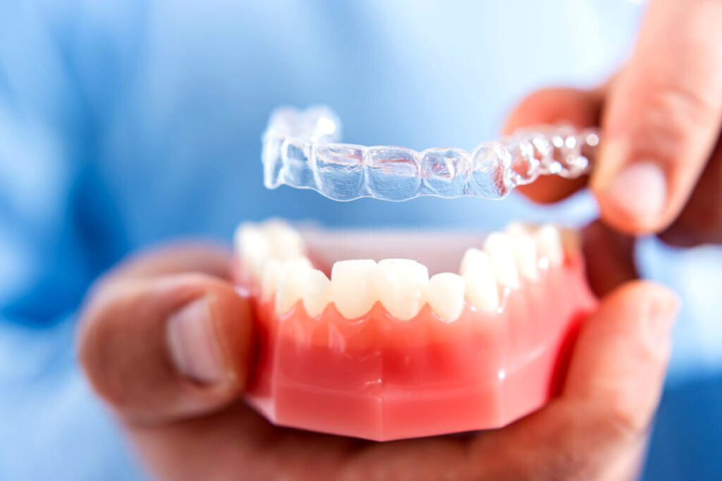 Invisalign Seu Novo Tratamento Ortod Ntico Est Tico Maisodonto