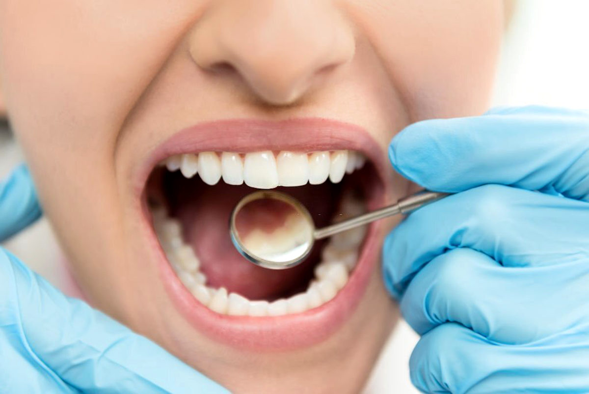 Recuperação de dentes com obturação de porcelana